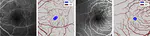 Improving foveal avascular zone segmentation in fluorescein angiograms by leveraging manual vessel labels from public color fundus pictures