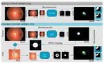 Assessing Coarse-to-Fine Deep Learning Models for Optic Disc and Cup Segmentation in Fundus Images