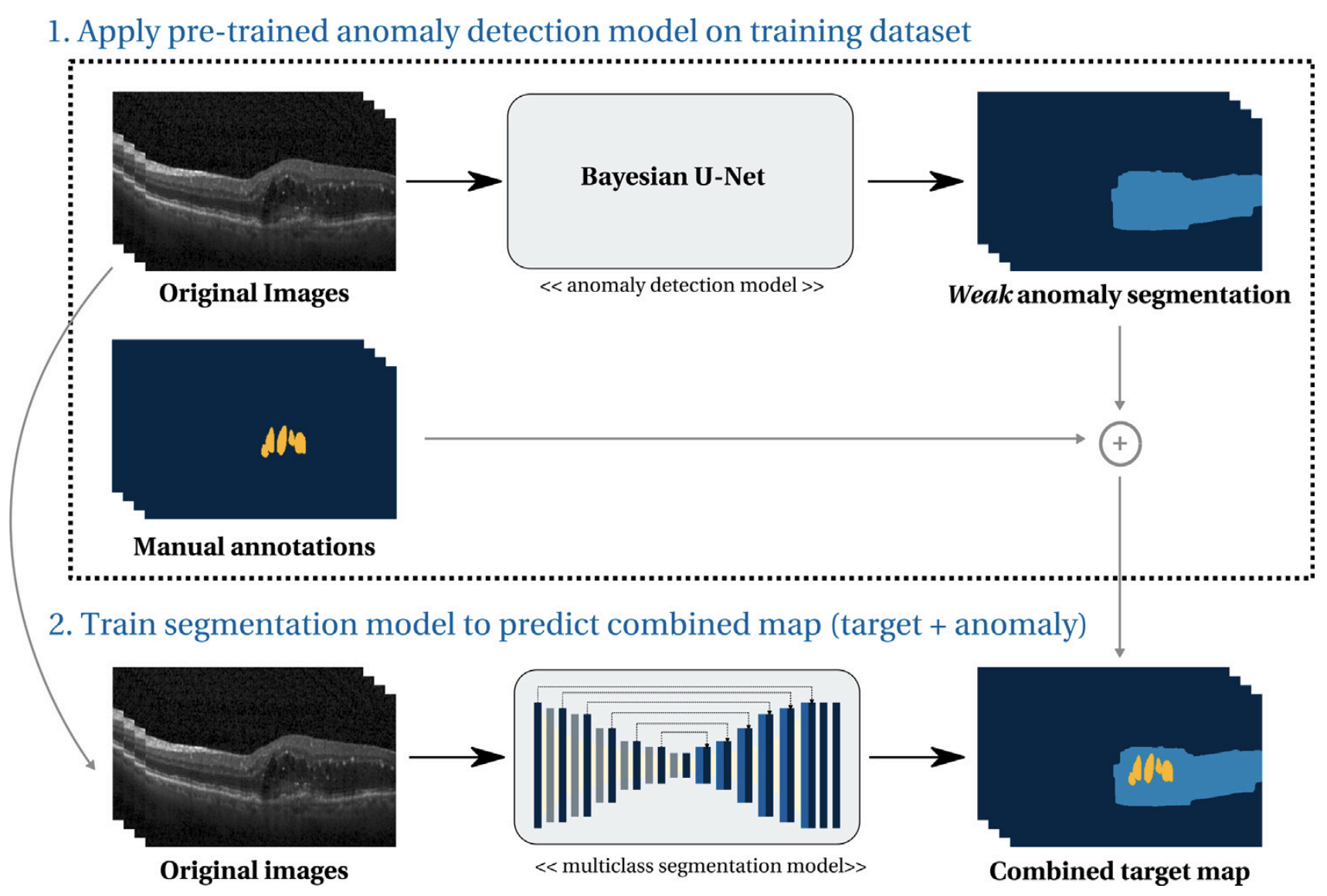 Anomaly guided segmentation introducing semantic context for lesion