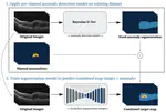 Anomaly guided segmentation: Introducing semantic context for lesion segmentation in retinal OCT using weak context supervision from anomaly detection