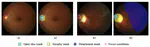 Open Fundus Photograph Dataset with Pathologic Myopia Recognition and Anatomical Structure Annotation
