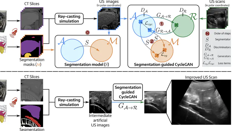 Improving realism in abdominal ultrasound simulation combining a segmentation-guided loss and polar coordinates training