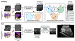 Improving realism in abdominal ultrasound simulation combining a segmentation-guided loss and polar coordinates training