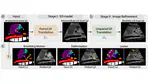Abdominal Ultrasound Simulation from Semantic Labels using Paired Label-to-Physics-Based Image Translation