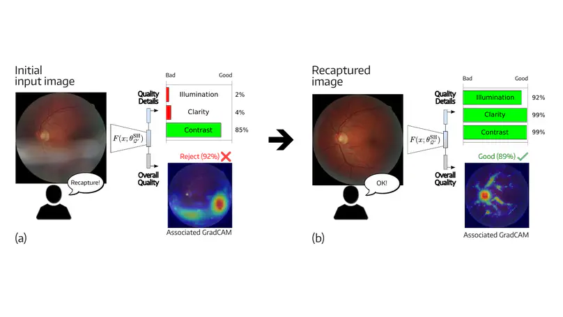 Semi-Supervised Multi-Task Learning for Interpretable Quality Assessment of Fundus Images