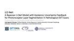 U2-Net: A Bayesian U-Net Model with Epistemic Uncertainty Feedback for Photoreceptor Layer Segmentation in Pathological OCT Scans